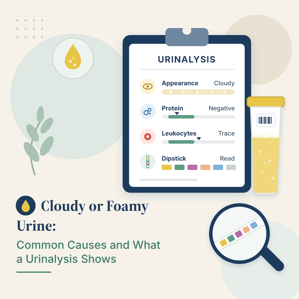 Urine sample cup showing cloudy urine beside a urinalysis report with dipstick results for protein and white blood cells